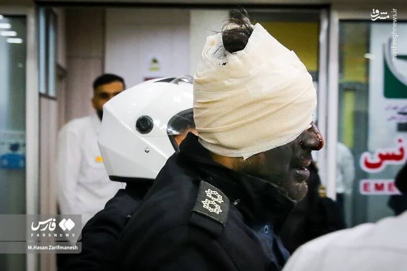  تصویری تلخ از مجروحیت افسر پلیس در چهارشنبه‌سوری (۱۶+)