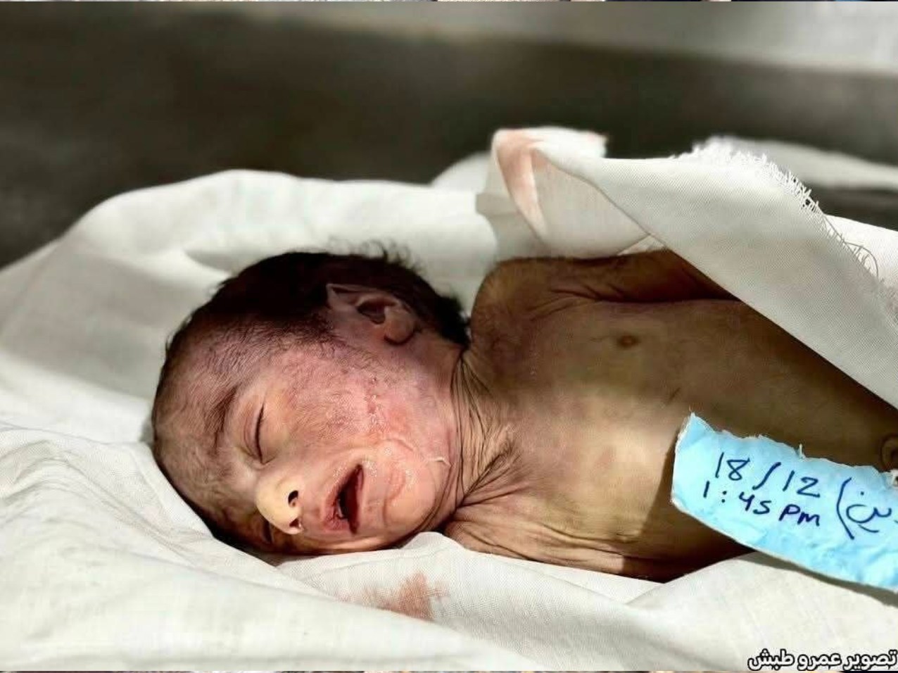 غزه؛ دیروز غرق در خون، امروز غرق در سیلاب